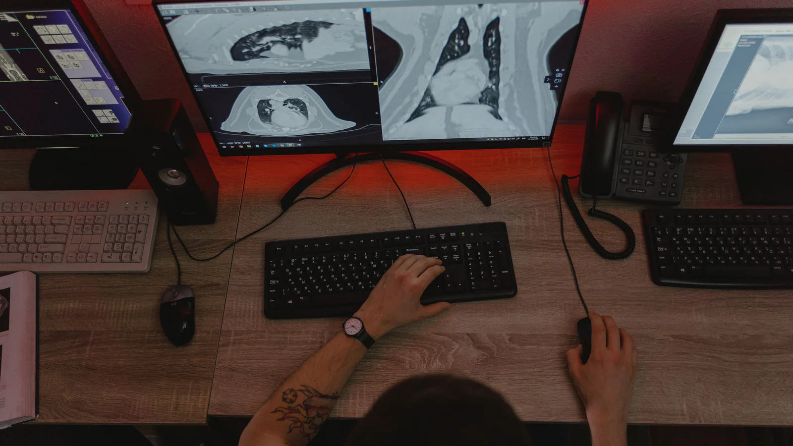 Person reviewing lung scans at a medical imaging workstation