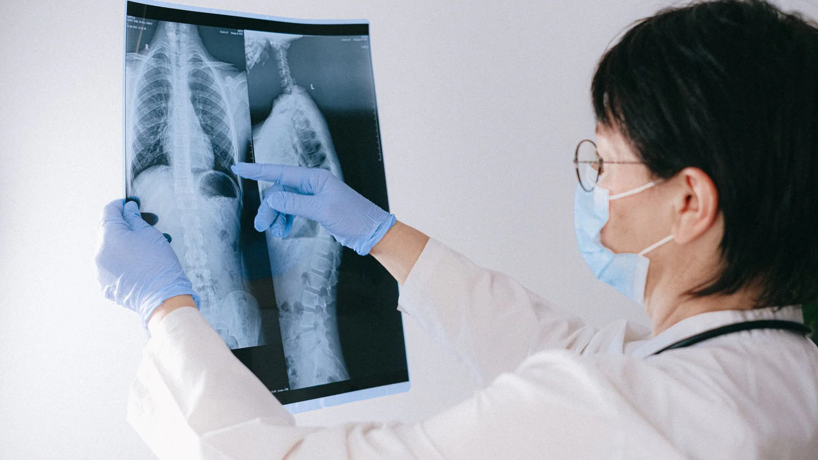 Medical professional reviewing a chest radiograph in a clinical setting
